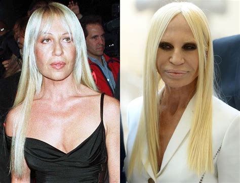 donatella versace cirugias|donatella versace before and after.